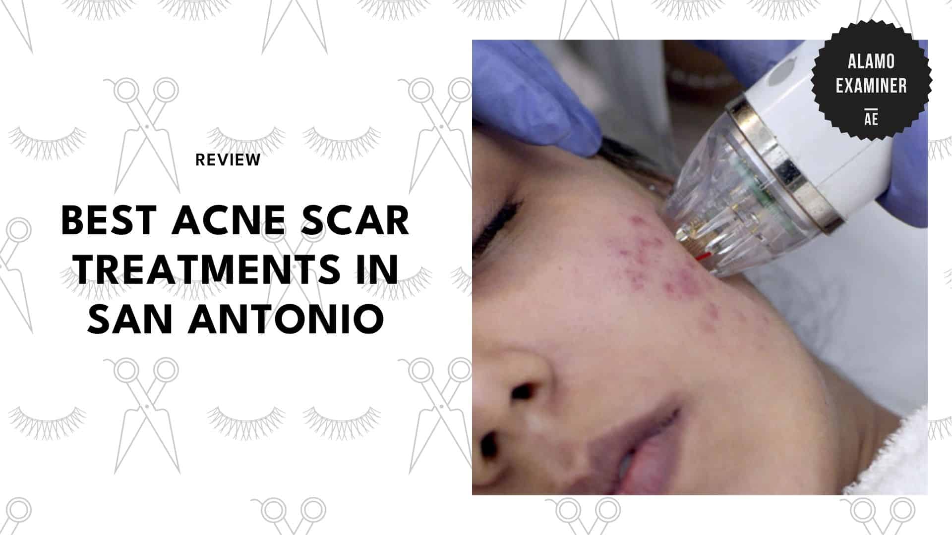 best-acne-scar-treatment-san-antonio