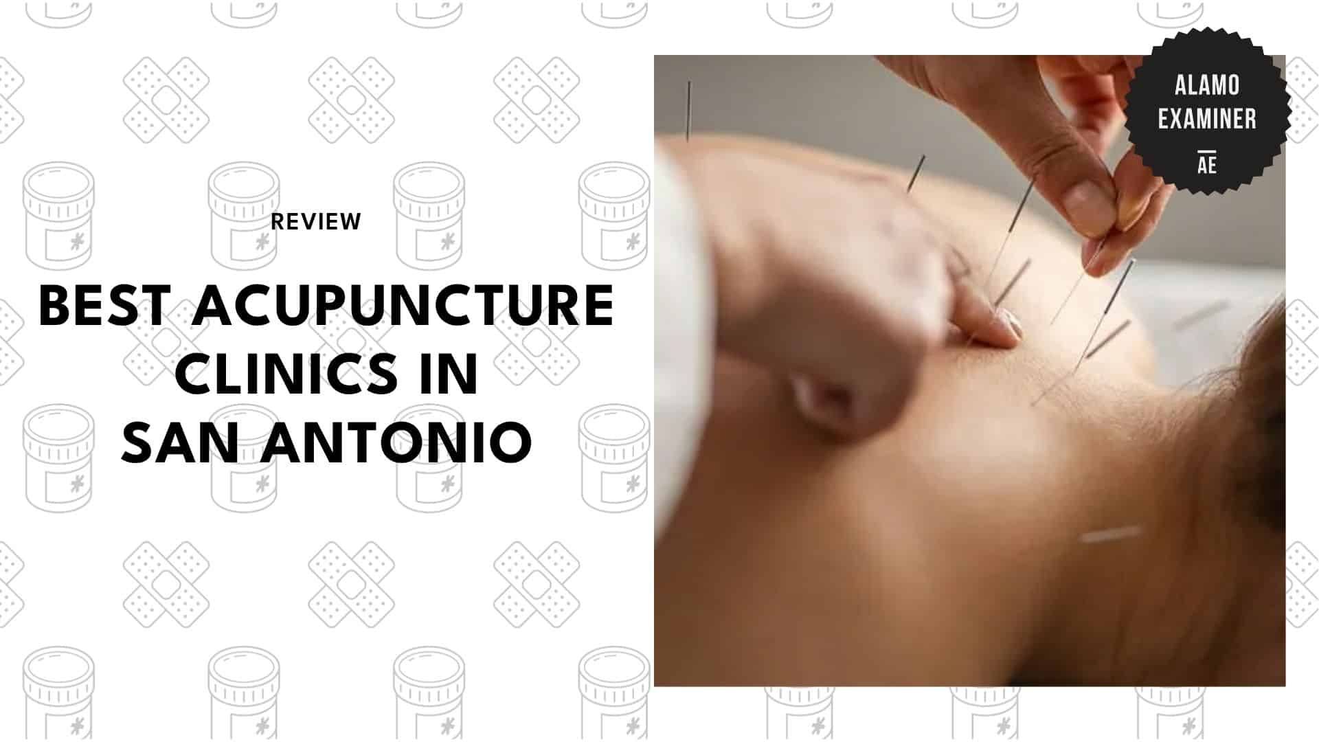 acupuncture-spots-in-san-antonio
