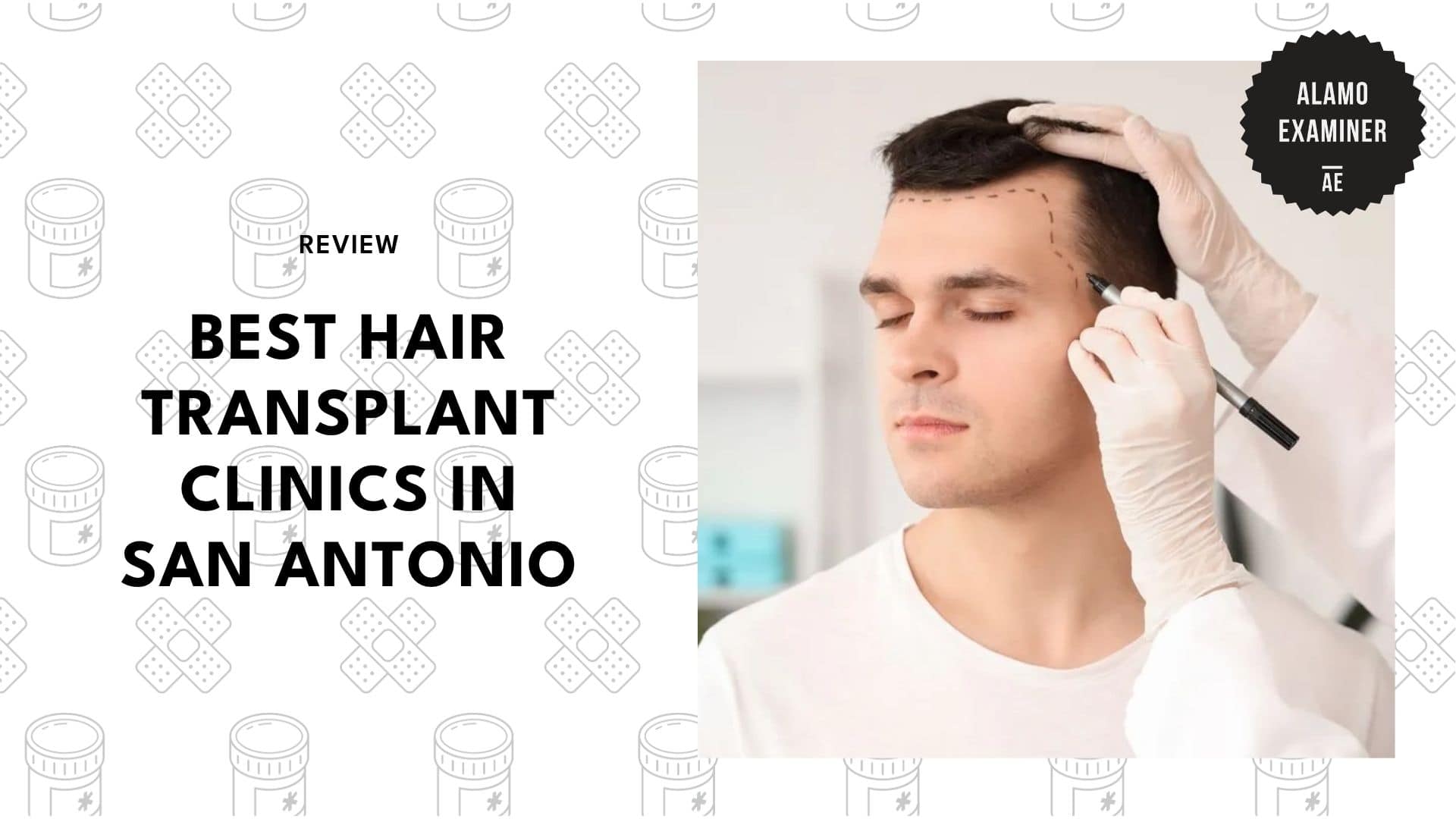 best-hair-transplant-san-antonio
