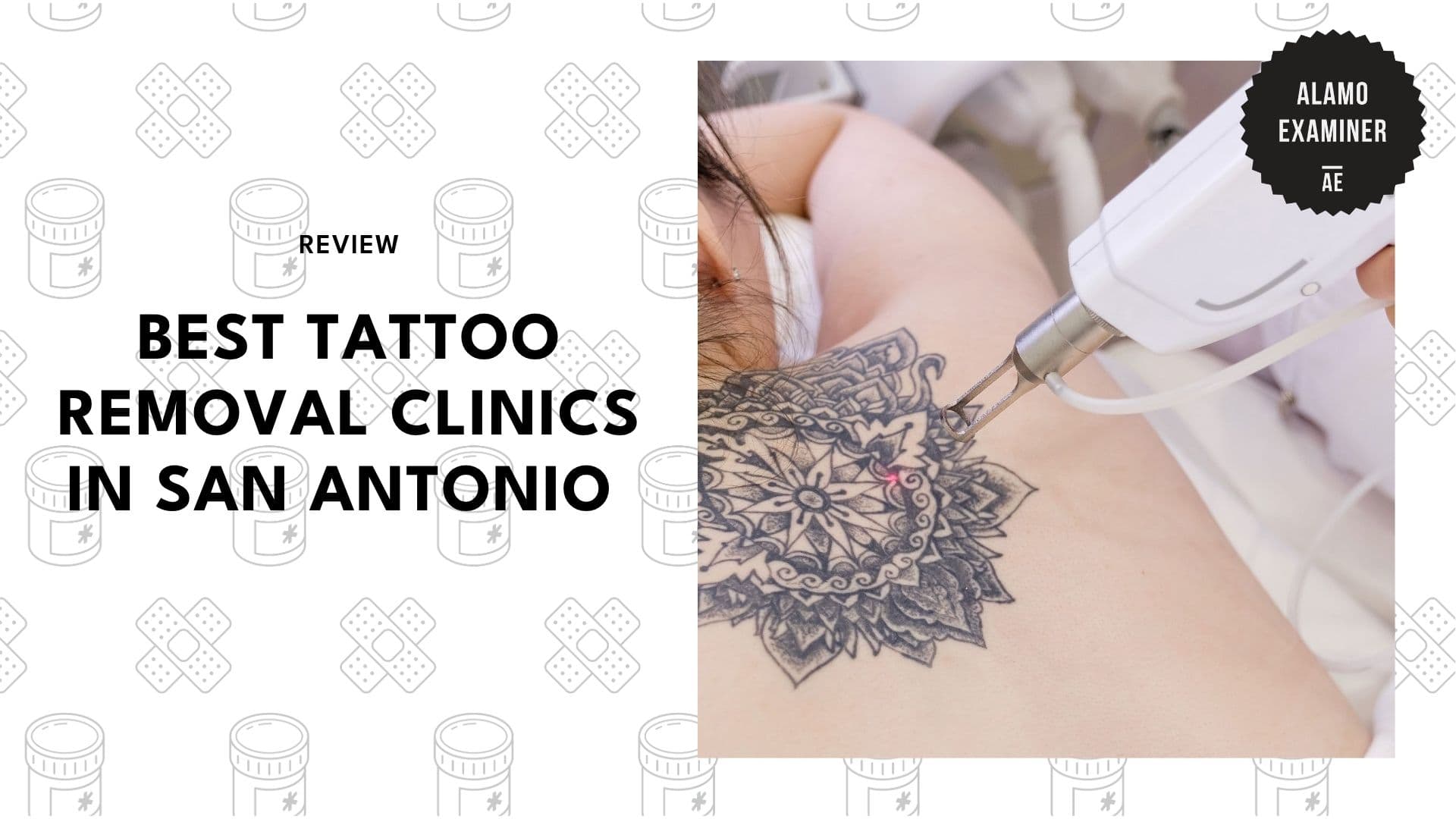 best-tattoo-removal-san-antonio