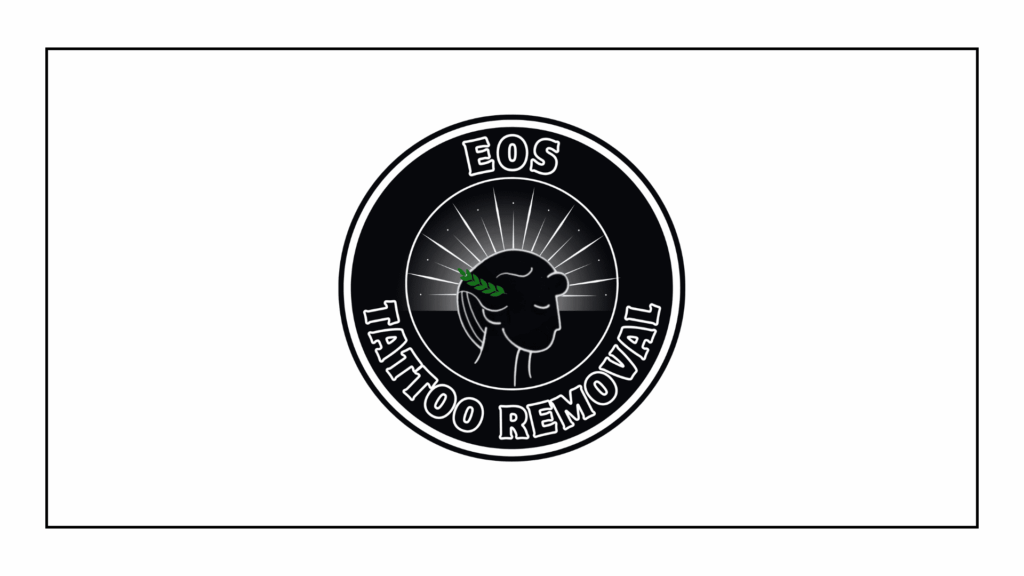 eos-tattoo-removal