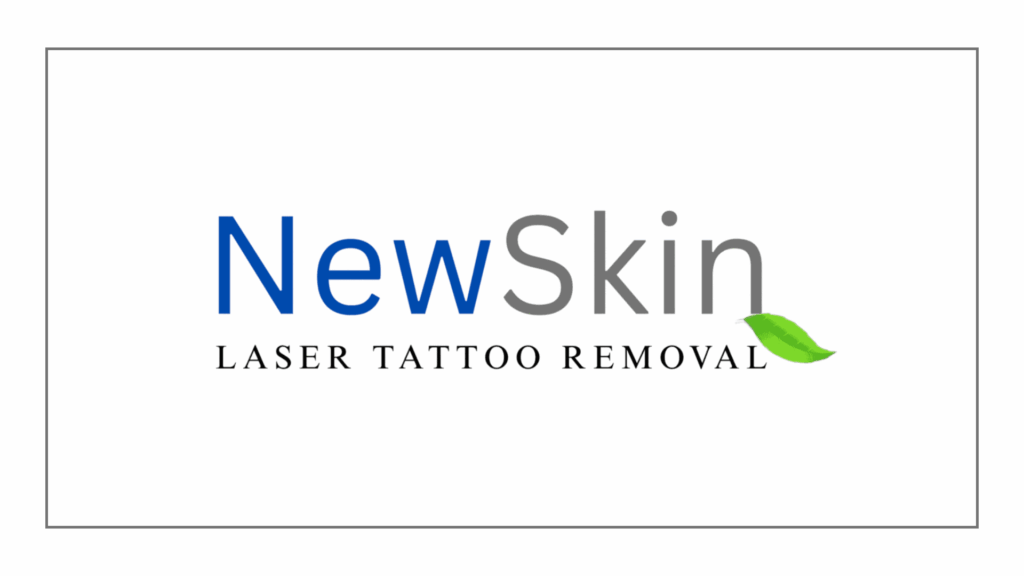 newskin-laser-tattoo-removal